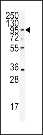 ADAMTS13 Antibody in Western Blot (WB)