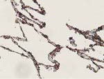 ADH1B Antibody in Immunohistochemistry (Paraffin) (IHC (P))