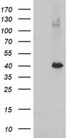 ADH1B Antibody in Western Blot (WB)