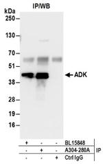 ADK Antibody in Western Blot (WB)