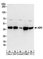 ADK Antibody in Western Blot (WB)