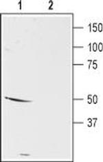 D5 Dopamine Receptor (extracellular) Antibody in Western Blot (WB)