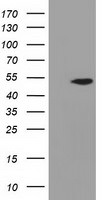 ADSL Antibody in Western Blot (WB)