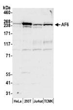AF6 Antibody in Western Blot (WB)