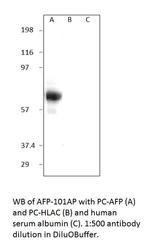 Alpha 1 Fetoprotein Antibody in Western Blot (WB)