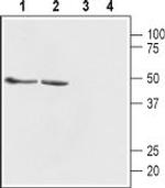 GABA(A) beta 1 Receptor Antibody in Western Blot (WB)