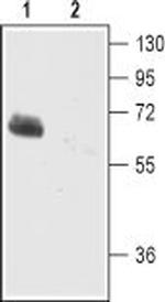 EAAT2 (GLT-1) (extracellular) Antibody in Western Blot (WB)