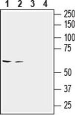 SLC6A14 (extracellular) Antibody in Western Blot (WB)