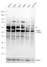 TGFBR1 Antibody in Western Blot (WB)