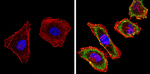 EGFR Antibody in Immunocytochemistry (ICC/IF)