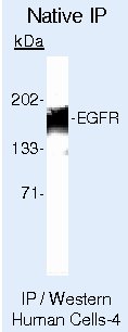 EGFR Antibody in Immunoprecipitation (IP)