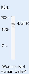 EGFR Antibody in Western Blot (WB)