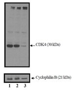 CDK4 Antibody in Western Blot (WB)