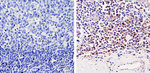 CDK6 Antibody in Immunohistochemistry (Paraffin) (IHC (P))