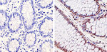 CDK6 Antibody in Immunohistochemistry (Paraffin) (IHC (P))