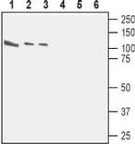 CASK Antibody in Western Blot (WB)