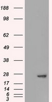 AK1 Antibody in Western Blot (WB)