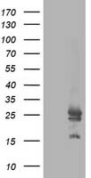 AK4 Antibody in Western Blot (WB)