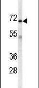 Adenylate Kinase 7 Antibody in Western Blot (WB)