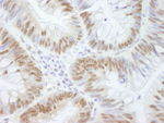 AKAP8/AKAP95 Antibody in Immunohistochemistry (IHC)