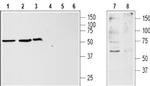 KISS1 Receptor (GPR54) (extracellular) Antibody in Western Blot (WB)