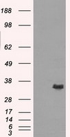 AKR1A1 Antibody in Western Blot (WB)