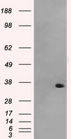 AKR1A1 Antibody in Western Blot (WB)