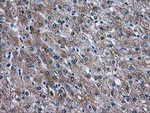 AKT2 Antibody in Immunohistochemistry (Paraffin) (IHC (P))