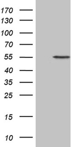 ALAS2 Antibody in Western Blot (WB)