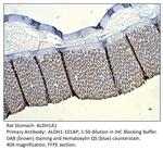 ALDH1A1 Antibody in Immunohistochemistry (IHC)