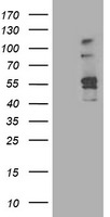 ALDH3A2 Antibody in Western Blot (WB)