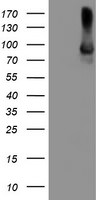 ALOX15 Antibody in Western Blot (WB)