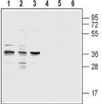 CysLTR1 (extracellular) Antibody in Western Blot (WB)