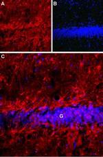 Latrophilin-1 (LPHN1) (extracellular) Antibody in Immunohistochemistry (IHC)