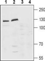 Latrophilin-1 (LPHN1) (extracellular) Antibody in Western Blot (WB)