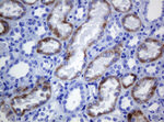 AMACR Antibody in Immunohistochemistry (Paraffin) (IHC (P))