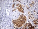 AMACR Antibody in Immunohistochemistry (Paraffin) (IHC (P))