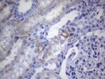 AMACR Antibody in Immunohistochemistry (Paraffin) (IHC (P))