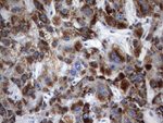 AMACR Antibody in Immunohistochemistry (Paraffin) (IHC (P))