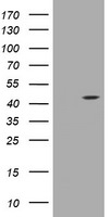 AMACR Antibody in Western Blot (WB)