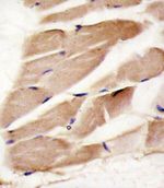 AMPK alpha-2 Antibody in Immunohistochemistry (IHC)