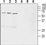 VMAT2 Antibody in Western Blot (WB)