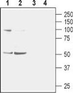 Nicotinic Acetylcholine Receptor alpha 2 (CHRNA2) (extracellular) Antibody in Western Blot (WB)
