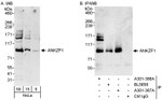 ANKZF1 Antibody in Western Blot (WB)