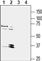 NPY1R (extracellular) Antibody in Western Blot (WB)