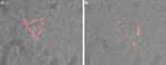 CD56/NCAM1 (extracellular) Antibody in Immunocytochemistry (ICC/IF)