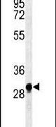 ANR49 Antibody in Western Blot (WB)