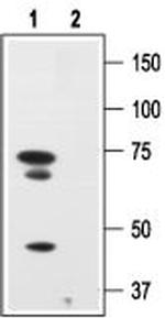 p75 NGF Receptor (extracellular) Antibody in Western Blot (WB)