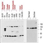 p75 NGF Receptor (extracellular) Antibody in Western Blot (WB)