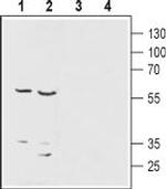 ENT1 (SLC29A1) Antibody in Western Blot (WB)